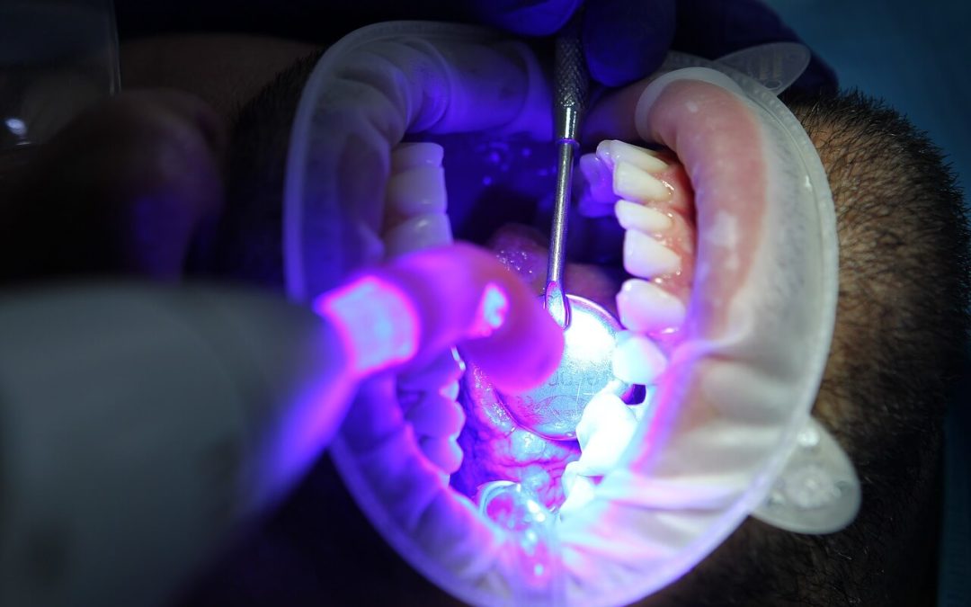 Homem fazendo clareamento dental